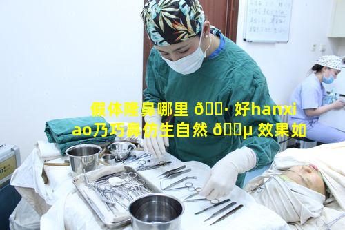 假体隆鼻哪里 🕷 好hanxiao乃巧鼻仿生自然 🐵 效果如何